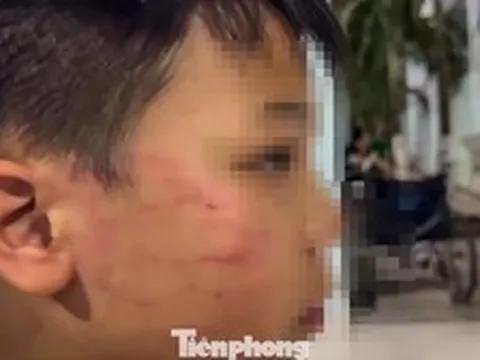 Tin mới vụ giáo viên người nước ngoài tát vào mặt học sinh