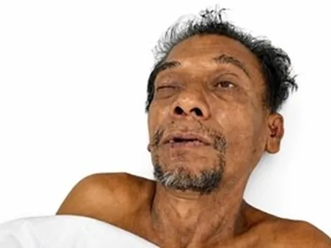 Tìm người thân của cụ ông bị tai nạn nguy kịch ở Tây Ninh