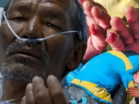 Kỳ tích trên Everest: Người đàn ông sống sót sau 7 ngày mất tích ở "vùng tử thần"