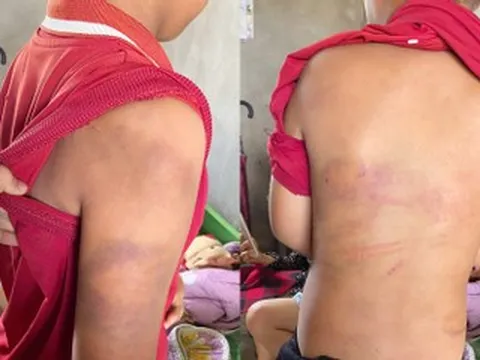 Đến thăm cháu trai, bà ngoại phát hiện chuyện đau lòng, vội trình báo công an