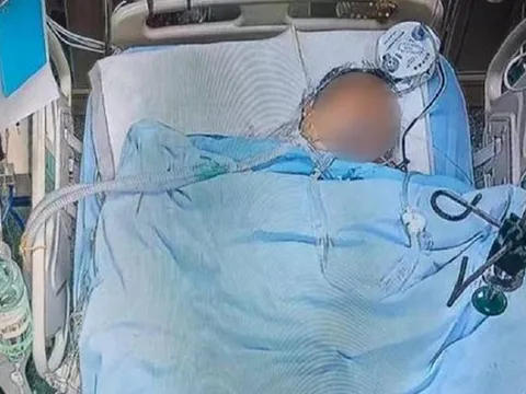 Người đàn ông 60 tuổi tử vong, bác sĩ nói ngay: Mùa hè thà ăn ít thịt cũng đừng quên 5 món "vạn người mê" này