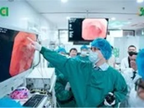 Khi nào người trẻ nên đi nội soi tiêu hóa?