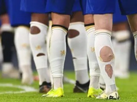 Phát hiện nhiều cầu thủ World Cup đi tất rách ra sân