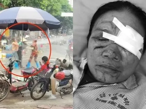 Liên tiếp xảy ra vụ xịt vòi nước cao áp vào người khác, luật sư nói gì?