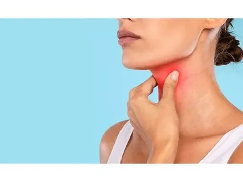 4 dấu hiệu ung thư amidan dễ bị bỏ qua
