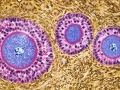 Nghiên cứu mới: Buồng trứng không 'nghỉ hưu' sau mãn kinh