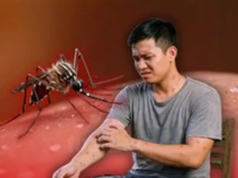 Không phải 'thịt thơm' hay máu O, đây mới là nguyên nhân muỗi 'chọn' bạn để đốt