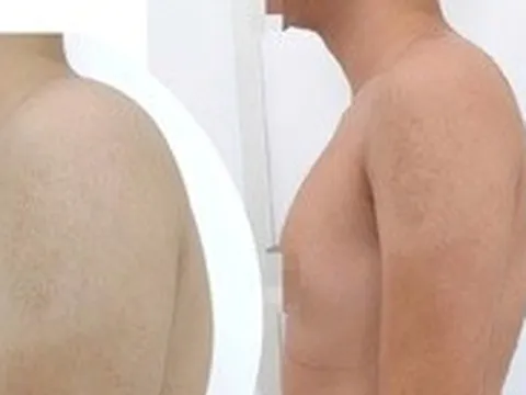Cổ rụt, lưng gù vì ngồi vẹo vọ, bò dài trên bàn: Chữa thế nào?