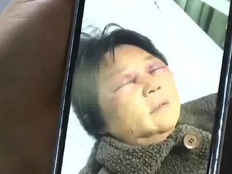 Từ chối chăm cháu, mẹ chồng bị con dâu hành hung đến gãy xương sườn