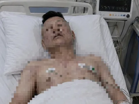 Người đàn ông 46 tuổi tử vong trên giường, bác sĩ cảnh báo loại đồ uống quen thuộc "vạn người mê"