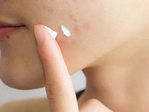 Thu hồi 5 sản phẩm mỹ phẩm của Công ty Kencare Việt Nam