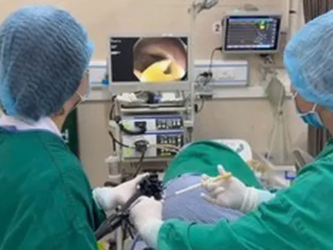 Thường xuyên ăn thịt bò tái, đi khám, người đàn ông phát hiện sán dây bò dài 1,2 mét trong ruột