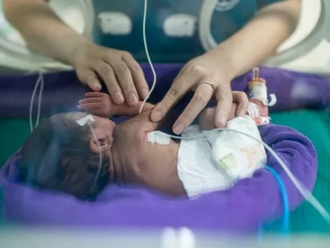 Úc phát triển nhau thai nhân tạo, mở ra hy vọng mới cho trẻ sinh non