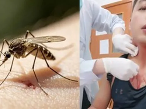 Một người đàn ông suýt chết vì bị muỗi đốt sau khi tập thể dục!