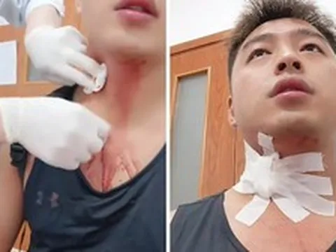 Người đàn ông suýt "gặp họa" vì một cú đập muỗi làm vỡ mạch máu ở cổ