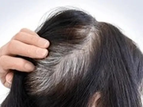Mới chút xíu tuổi tóc đã bạc