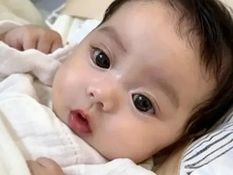 4 đặc điểm "xấu lạ" lúc mới sinh lại là dấu hiệu em bé của mẹ càng lớn lại càng xinh