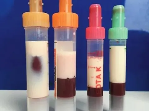 Bé trai 5 tuổi máu "trắng đục như sữa" vì thường xuyên ăn món canh quen thuộc
