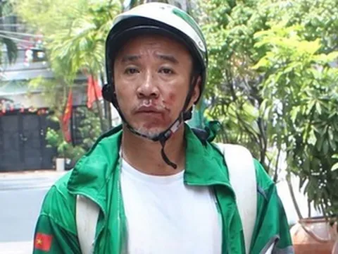 Khởi tố kẻ cướp giật nguy hiểm, kéo lê nạn nhân trên đường ở TPHCM