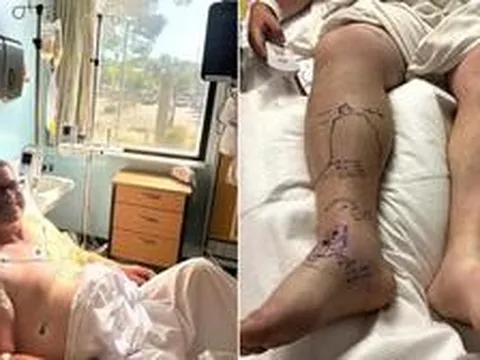Bị rắn đuôi chuông cắn 2 lần, người đàn ông dùng 54 lọ huyết thanh và nhận hóa đơn viện phí 1,3 triệu USD