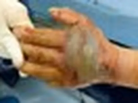 Chặt đầu con rắn hổ mang xong, 5 phút sau người đàn ông định nhặt lên thì bị cắn 1 cú chí mạng