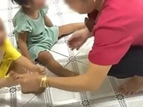 Bảo mẫu trường mầm non thừa nhận bắn dây thun vào chân trẻ