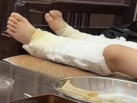 Cậu bé gãy cả hai xương gót chân vì bắt chước siêu nhân nhảy từ trên cao