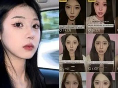 Nữ Tiktoker 24 tuổi nổi tiếng qua đời sau một tháng điều trị do tai nạn giao thông nghiêm trọng