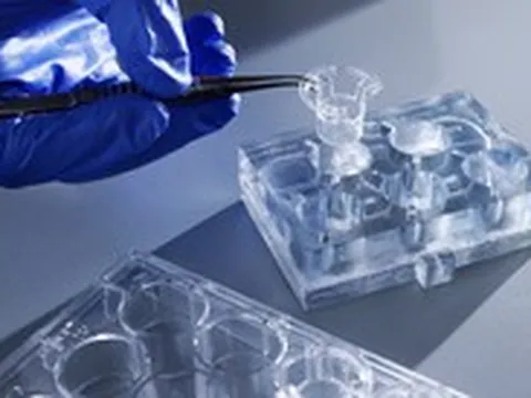 Nuôi ‘cơ quan người tí hon’ để tìm đúng thuốc cho từng bệnh nhân