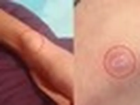 Bố mẹ đi làm xa, khi về nhà thì sốc với các vết thương trên cơ thể con trai, nghe lời kể càng bàng hoàng