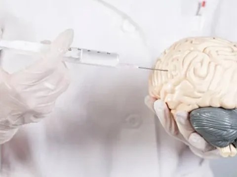 Người già đua nhau tiêm thuốc ‘bổ não’: Hiệu quả có như lời đồn?