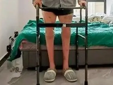 Lần đầu tiên trên thế giới: Bác sĩ Trung Quốc nối thành công hai chân đứt lìa