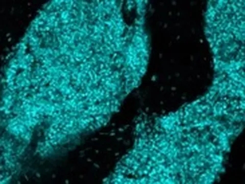 Phát hiện 'trạm miễn dịch' chưa từng biết trong hộp sọ, có thể giúp chống ung thư não