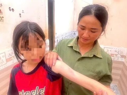 Người dân kể phút lốc xoáy cuốn qua: 'Gió rít mạnh, các con tôi hoảng loạn bỏ chạy'