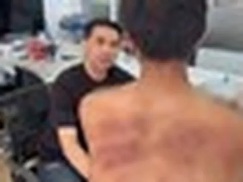 Nam thanh niên đi làm với mình mẩy thâm tím, sếp hỏi chuyện mới phát hiện nhân viên bị mẹ kế bạo hành