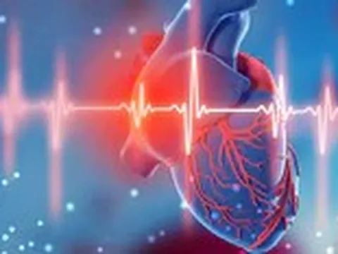Trước khi lên cơn đau tim, cơ thể có phản ứng nào đáng chú ý?