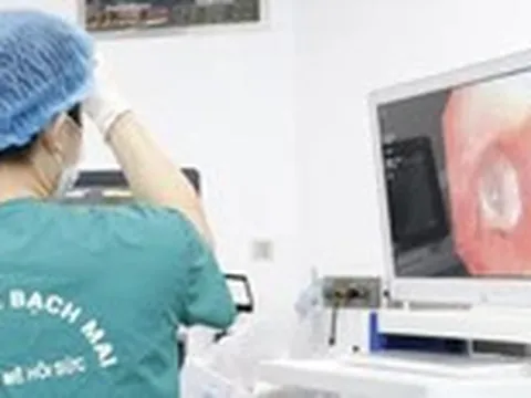 Viêm phổi tái phát, bác sĩ bất ngờ lấy ra... răng sâu trong phế quản