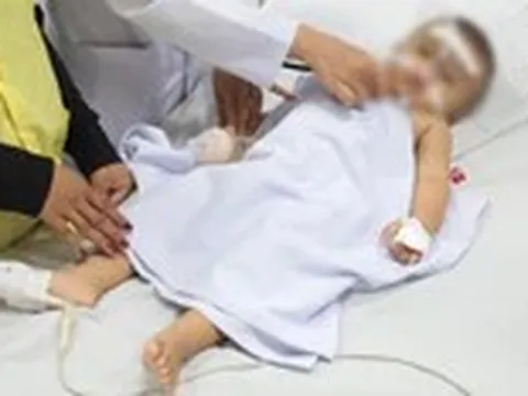 Nguy cơ sặc sữa ở trẻ và những điều ba mẹ cần biết