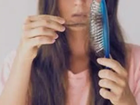 Rụng tóc mùa thu: Những bất thường cần chú ý