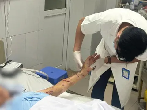 Nằm liệt giường, cụ bà 76 tuổi vẫn bị chó nhà tấn công phải nhập viện