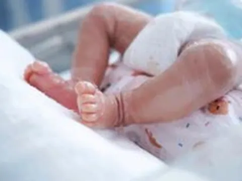 Da bé trai sơ sinh khô nứt bất thường, bác sĩ phát hiện mắc bệnh vảy cá hiếm gặp