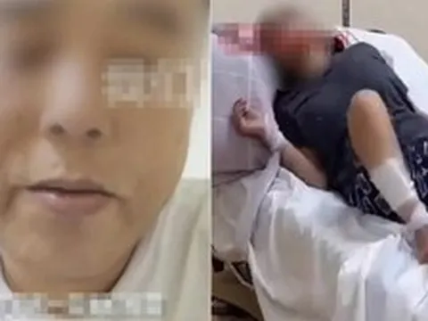 Người đàn ông bị chó cắn 47 ngày rồi qua đời: Bác sĩ nhắc điều phải làm ngay khi có vết thương