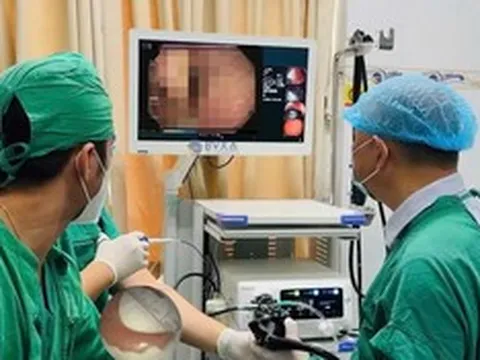 Đang uống nước, người đàn ông 51 tuổi bất ngờ nuốt nhầm thứ khó tin