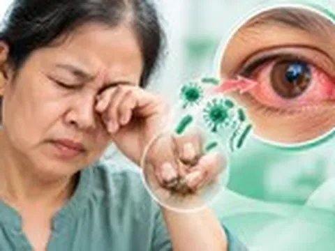 Suýt mất thị lực vì thói quen nhiều người gặp phải