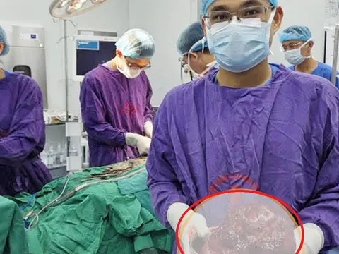 Bụng to bất thường, người đàn ông sốc khi bác sĩ gắp ra thứ "đáng sợ" nặng 2kg bên trong