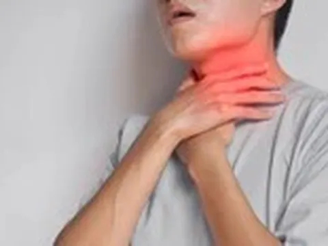 Đau họng kéo dài dù không ốm sốt hay cảm lạnh, nên nghĩ đến bệnh gì?